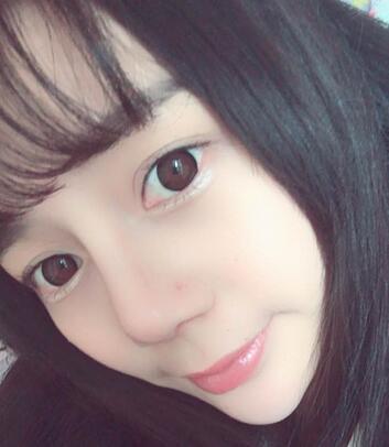 隆鼻修復(fù)術(shù)后恢復(fù)期經(jīng)歷