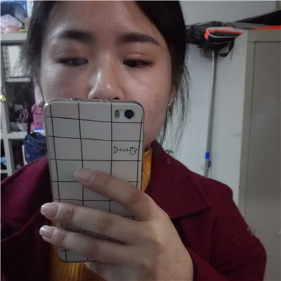 注射瘦臉去魚尾紋恢復(fù)過程和前后對(duì)比果圖片分享，上海東方做的~