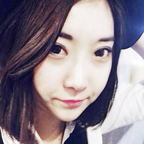 米蘭柏羽做了外切去眼袋，分享手術(shù)前后對(duì)比果圖片哦~