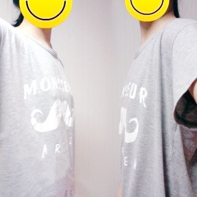 自體脂肪移植隆胸恢復過程和前后對比果圖片分享哦~