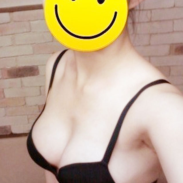 自體脂肪移植隆胸恢復過程和前后對比果圖片分享哦~