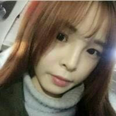 玻尿酸注射隆鼻三個(gè)月了，分享術(shù)后恢復(fù)照片哇~