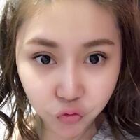 做鼻部綜合整形真是一件正確的決定，鼻子恢復(fù)過程分享