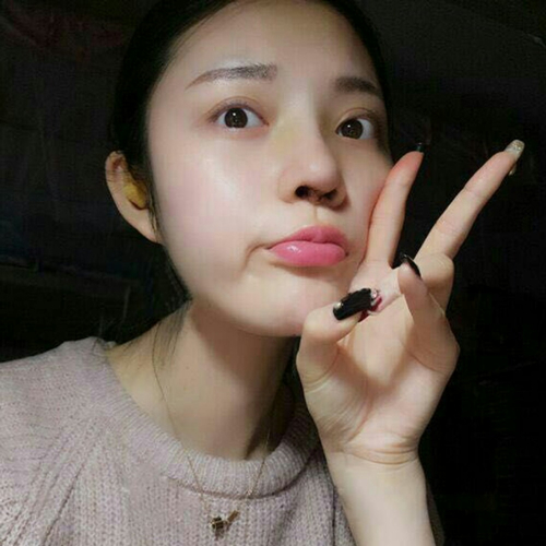 做了隆鼻整形手術好看多了，分享前后對比果照片~