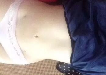 吸脂減肥恢復圖，腰上傷口還未完全恢復