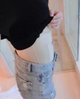 吸脂減肥瘦腰腹術后第7天