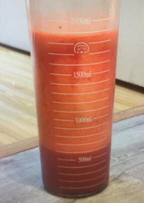 吸脂減肥手術抽出這么多大腿脂肪