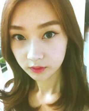 地包天手術前后過程以及對比照，真實案例分享