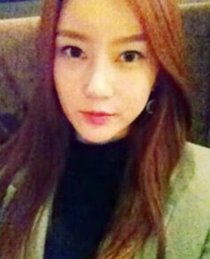 地包天手術前后過程以及對比照，真實案例分享