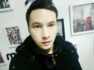 記錄了隆鼻整形（膨體隆鼻+鼻翼縮小）手術前后的過程，還有對比照片哦