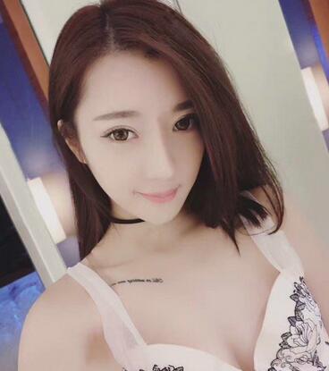 雙眼皮修復(fù)+自體脂肪填充恢復(fù)日記