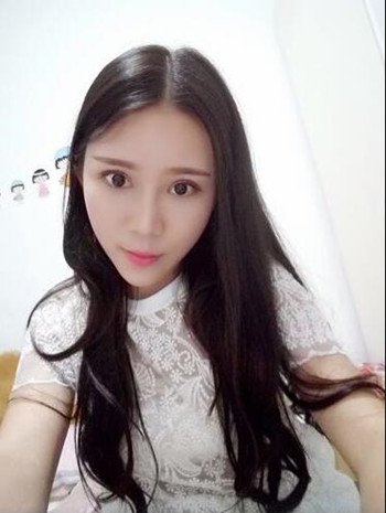 我的自體脂肪豐額頭+豐臉頰+雙眼皮+開眼角的真實(shí)經(jīng)歷 還有果圖哦