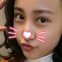 割雙眼皮恢復(fù)過程分享，整形價格3800元