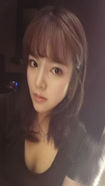 隆鼻整形手術(shù)后  我的高鼻梁養(yǎng)成記 內(nèi)有果對(duì)比圖