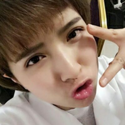 切開雙眼皮恢復過程分享，還有前后對比果圖片哦~