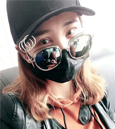 開內(nèi)眼角+切開雙眼皮前后對比果圖片分享，青島金島韓勝醫(yī)生做的~