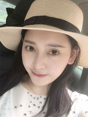 自體軟骨隆鼻手術(shù)前后過程以及對比照片分享