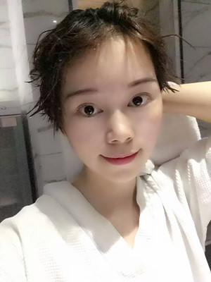 點陣激光祛痘前后過程對比照片分享，大家來看看果怎么樣