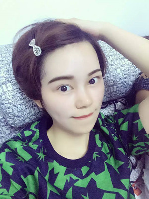 點陣激光祛痘前后過程對比照片分享，大家來看看果怎么樣