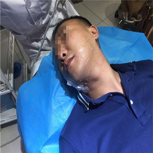 高強度聚焦超聲除掉小細紋，不再是女人的專*，我也可以擁有!!!