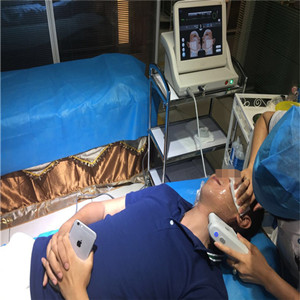 高強度聚焦超聲除掉小細紋，不再是女人的專*，我也可以擁有!!!