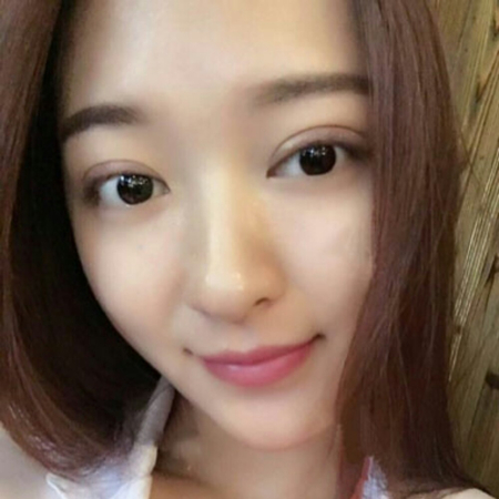 切開雙眼皮一個月了，分享恢復(fù)過程和前后對比果照片哦~