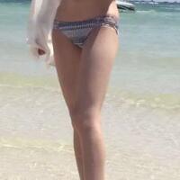 大腿吸脂減肥整形恢復(fù)經(jīng)歷分享，吸脂果不錯(cuò)