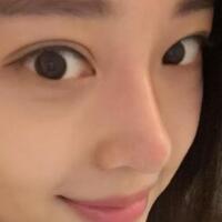 為什么大家覺得隆鼻恐怖，我就做了玻尿酸隆鼻，過程經(jīng)歷分享