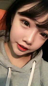 顴骨整形手術(shù)后，我也可以擁有精致小臉了