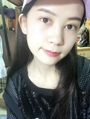 面部埋x后的恢復過程 快來看看我的果吧