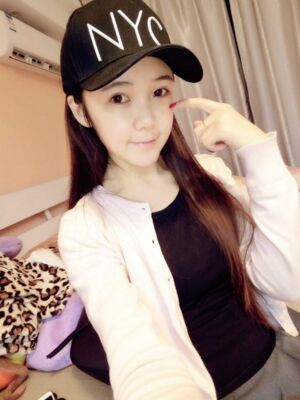 自體脂肪面部填充恢復時間挺短的，很快就自然了