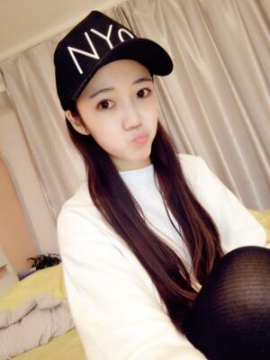 自體脂肪面部填充恢復時間挺短的，很快就自然了