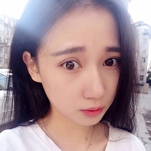 做雙眼皮兩個月了，分享恢復(fù)過程和前后對比果照片喲~