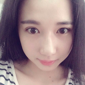 做雙眼皮兩個月了，分享恢復(fù)過程和前后對比果照片喲~