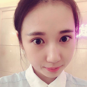 做雙眼皮兩個月了，分享恢復(fù)過程和前后對比果照片喲~