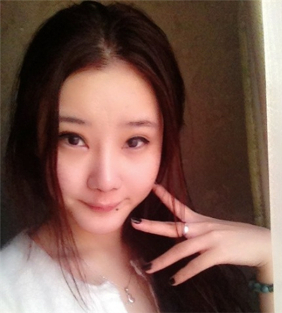 激光去雀斑+華爾茲冰點脫全身毛術(shù)后恢復(fù)過程照片分享~~