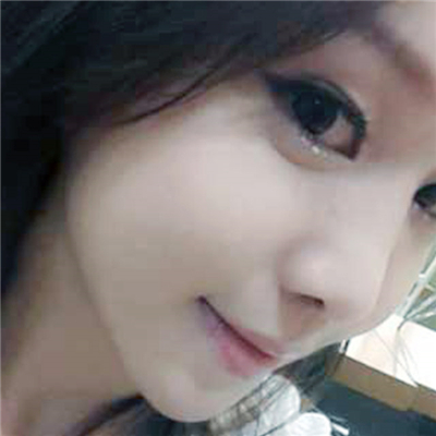 硅膠假體植入隆鼻兩個月了，分享手術過程和前后對比果圖片~