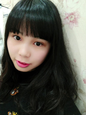 開內(nèi)眼角+雙眼皮手術(shù)后，我也變成大眼睛妹紙了