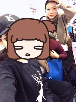 去年12月做的自體脂肪填充蘋果肌，大家來看看果怎么樣?