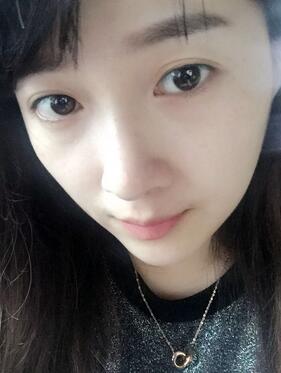 去魚尾紋的很好方法 注射瘦臉去魚尾紋果分享