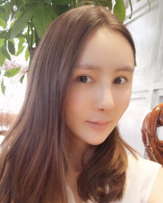 隆鼻整形+自體脂肪面部填充手術(shù)對(duì)比照片