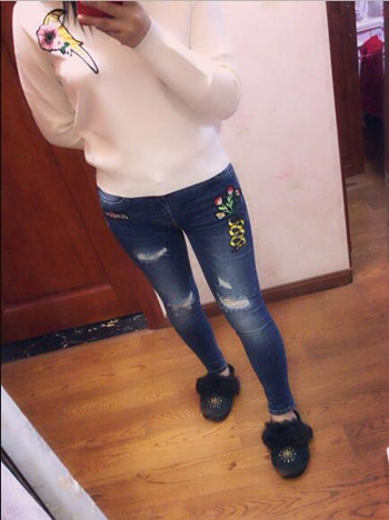 我的大腿吸脂真實(shí)果恢復(fù)對(duì)比案例圖