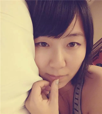 紅藍(lán)光祛痘手術(shù)恢復(fù)過(guò)程分享，還有前后對(duì)比果圖片哦~