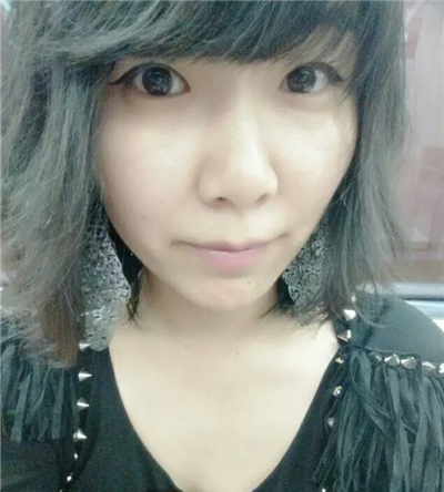 紅藍(lán)光祛痘手術(shù)恢復(fù)過(guò)程分享，還有前后對(duì)比果圖片哦~