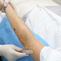 從小我就毛發(fā)旺盛，做了激光脫毛果圖分享給大家