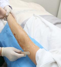 護(hù)士先剃除手臂多數(shù)體毛，還說我皮膚有些干燥