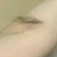 激光脫毛疼嗎？自己做了激光脫毛感覺(jué)還好