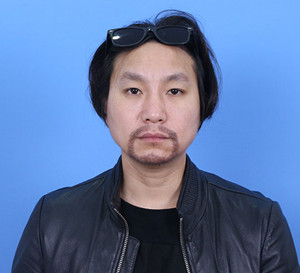 種植胡須手術(shù)前后過程以及對(duì)比照片分享