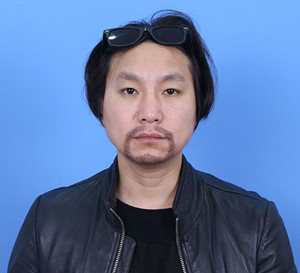 種植胡須手術(shù)前后過程以及對(duì)比照片分享