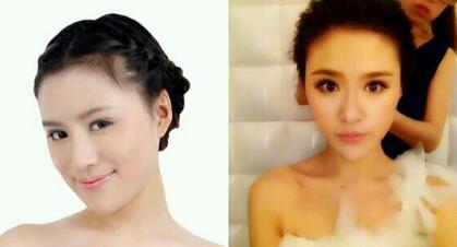 磨骨后下頜角恢復(fù)好后，覺(jué)得果很好，我又去做了鼻部整形，墊了下吧